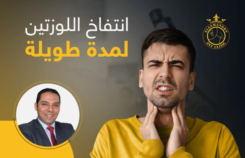 انتفاخ اللوزتين لمدة طويلة
