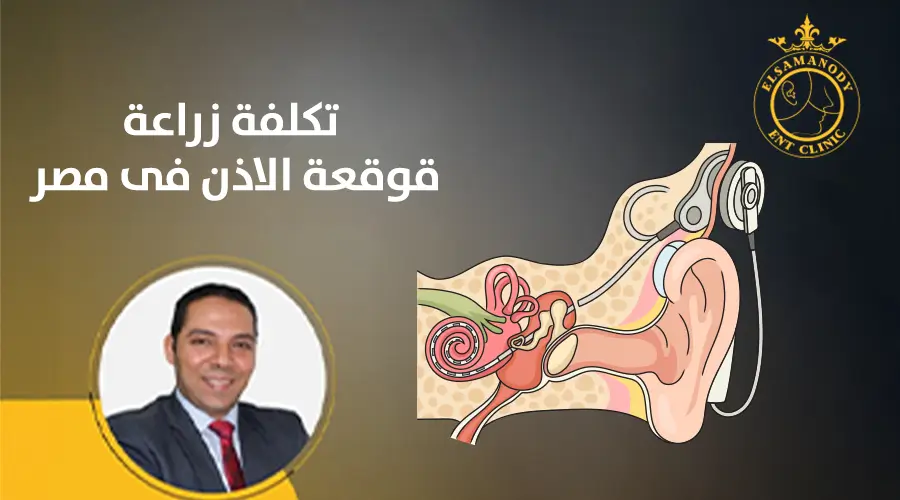 تكلفة زراعة قوقعة الاذن فى مصر