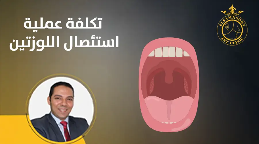 تكلفة عملية استئصال اللوزتين