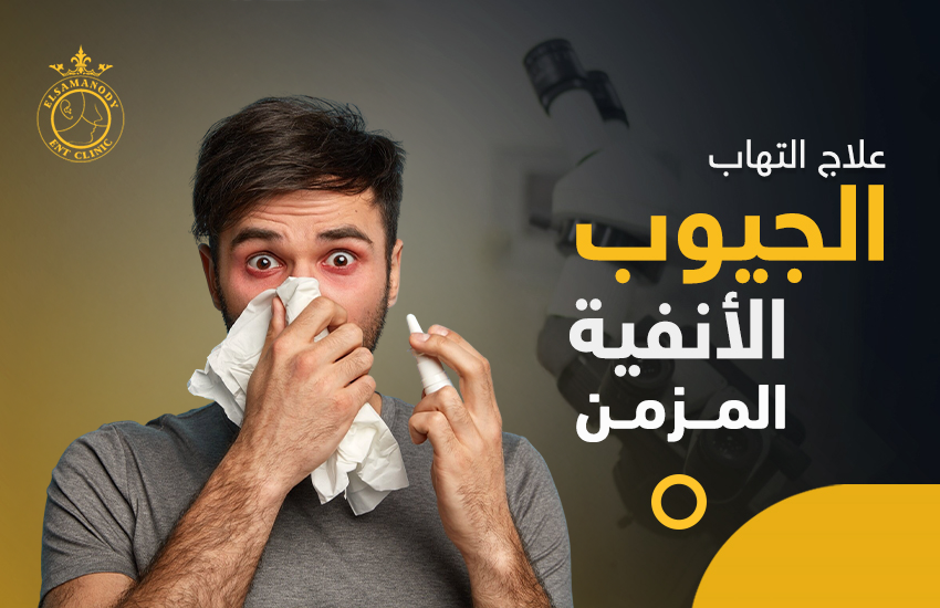 علاج التهاب الجيوب الانفية المزمن