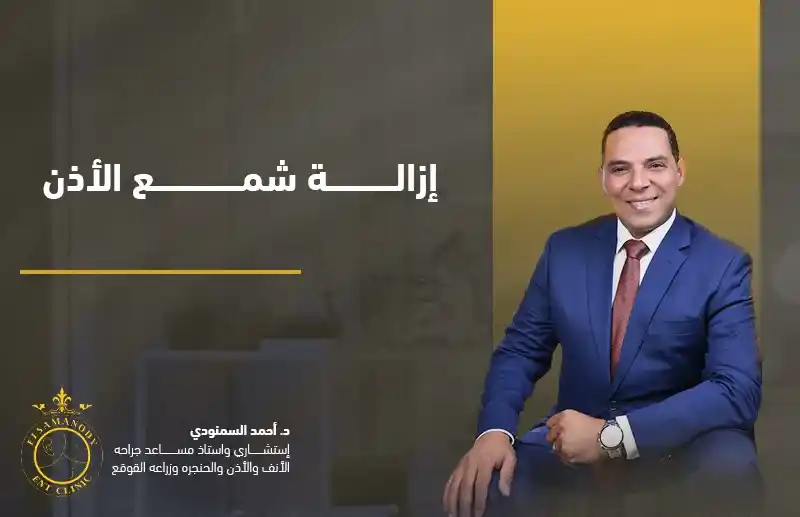 إزالة شمع الأذن