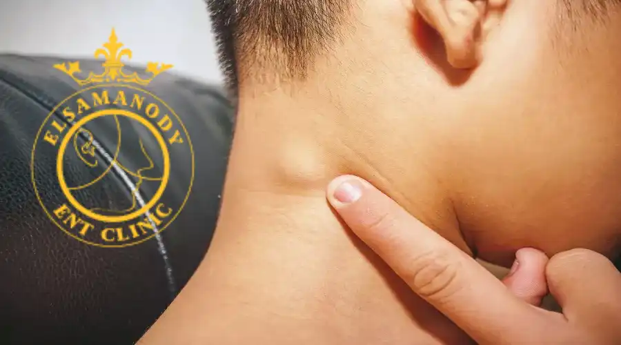 الغدد الليمفاوية عند الأطفال بالصور