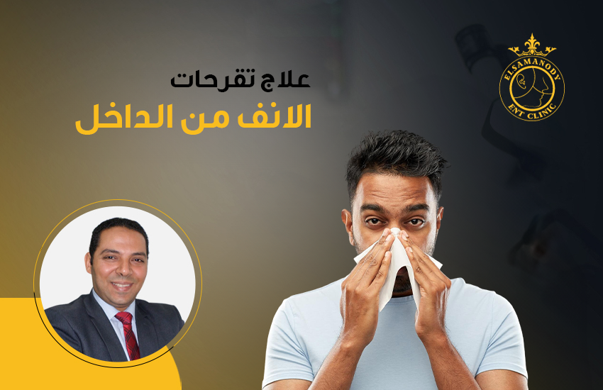 علاج تقرحات الانف من الداخل